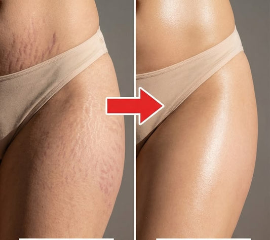 Disaaar Cocoa Butter Massage Cream for Stretch Marks 125g |cosmofair